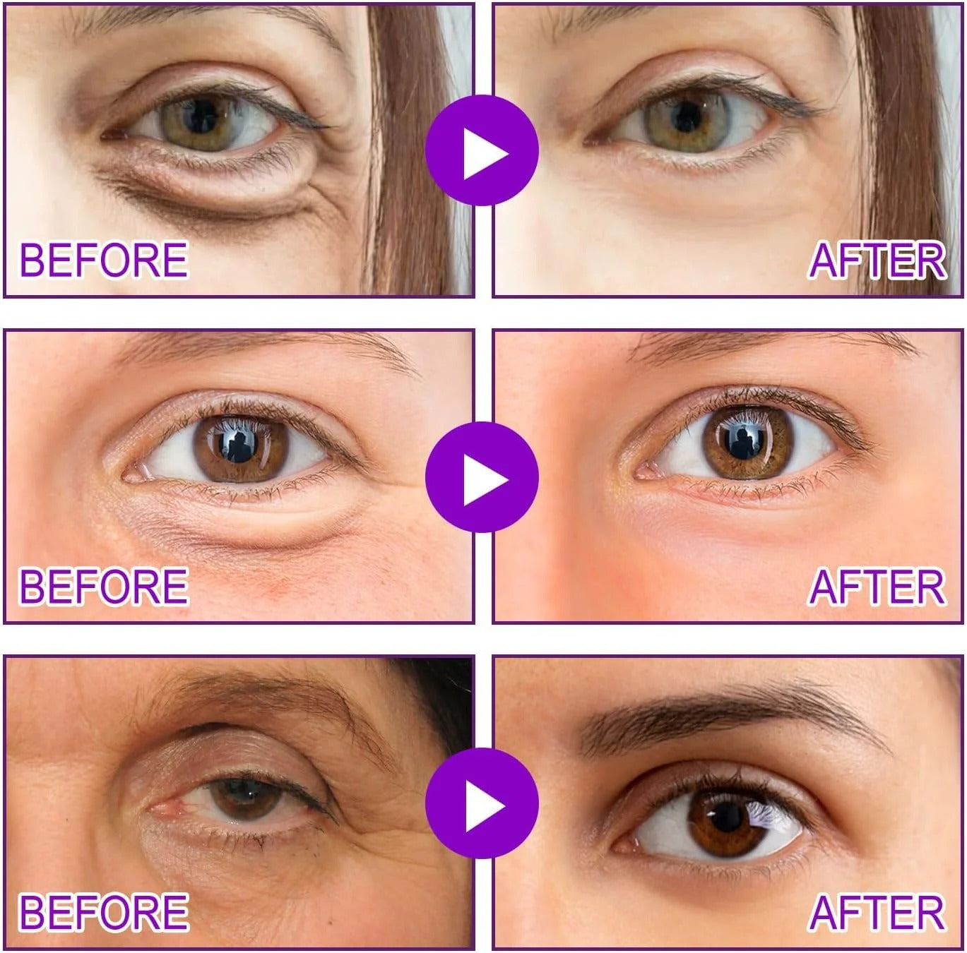 MicroGlow Patches by NOVALIFT